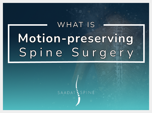 Motion-Preserving Spine Surgery Los Angeles