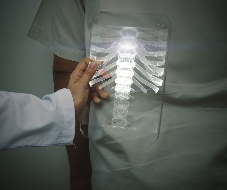 Minimally Invasive Spine Surgery vs Traditional Spine Surgery